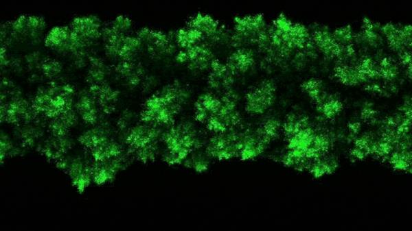 Bacterial co<em></em>lonies’ Clumpy Growth
